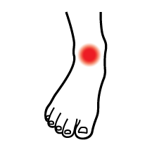Dr Kevin Driscoll ankle-pain-front-icon Platelet-Rich Plasma (PRP)  