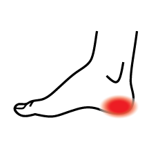 Dr Kevin Driscoll heal-pain-icon Heel Pain  